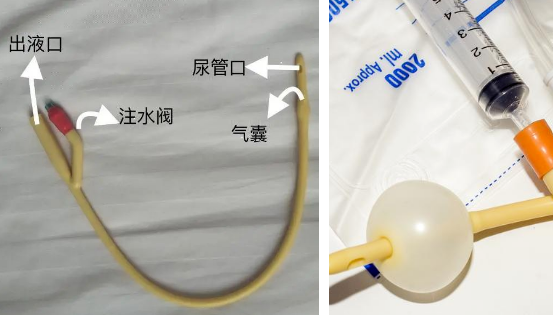 引流袋管子怎么不流小管子，大作用！导尿管知识问答~_https://www.jmylbn.com_新闻资讯_第3张