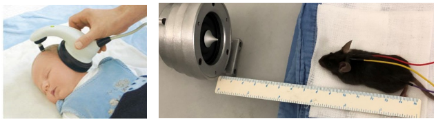 听性脑干反应检查是什么【麻醉医学专栏】新文速递-艾司氯胺酮与氯胺酮对听性脑干反应检测的影响_https://www.jmylbn.com_新闻资讯_第2张