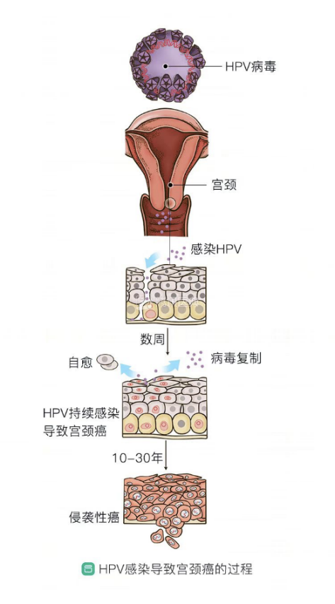 hpvdna分型分为什么型HPV基因分型检测临床应用_https://www.jmylbn.com_新闻资讯_第5张