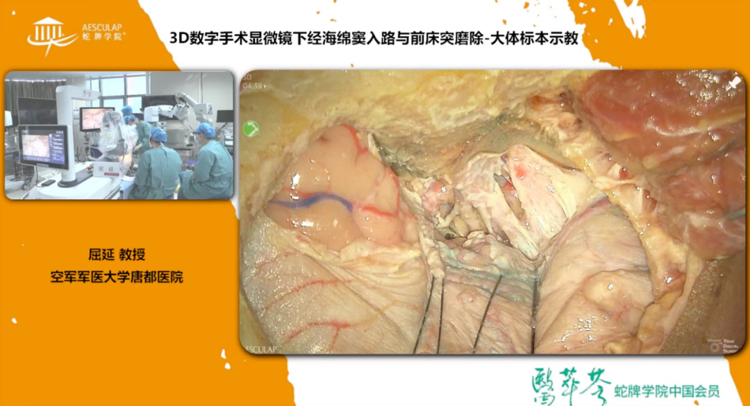 蛇牌学院是什么2022陕西省抗癌协会-蛇牌学院唐都微侵袭神经外科手术入路学习班顺利举办_https://www.jmylbn.com_新闻资讯_第13张