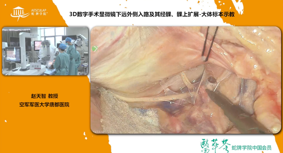 蛇牌学院是什么2022陕西省抗癌协会-蛇牌学院唐都微侵袭神经外科手术入路学习班顺利举办_https://www.jmylbn.com_新闻资讯_第14张