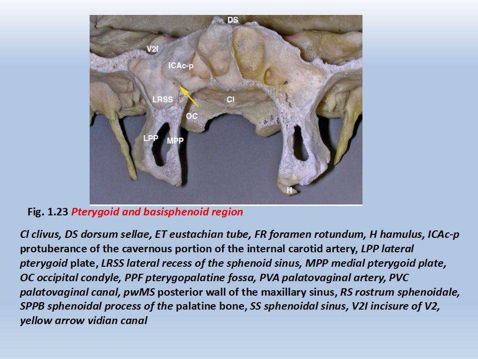 神经外科手术入路八颈静脉孔区