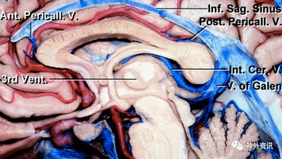 值得一提的是,顶盖前方的中脑导水管,可能受到肿瘤占位效应的影响