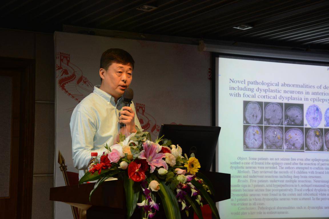 蔡立新教授的汇报主题为低龄儿童皮质发育障碍致难治性癫痫的手术治疗