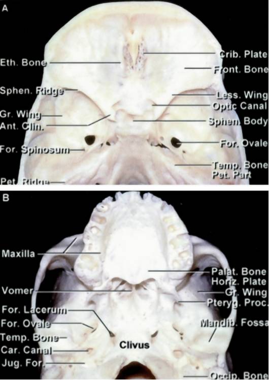 以下图像显示的是卵圆孔相关解剖结构手术解剖为了成功完成经皮神经根