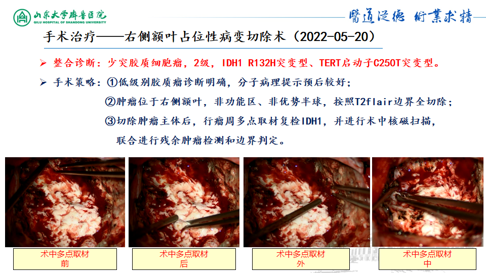 基因检测野生型什么意思_基因检测什么叫野生型_基因检测全是野生型好是不好
