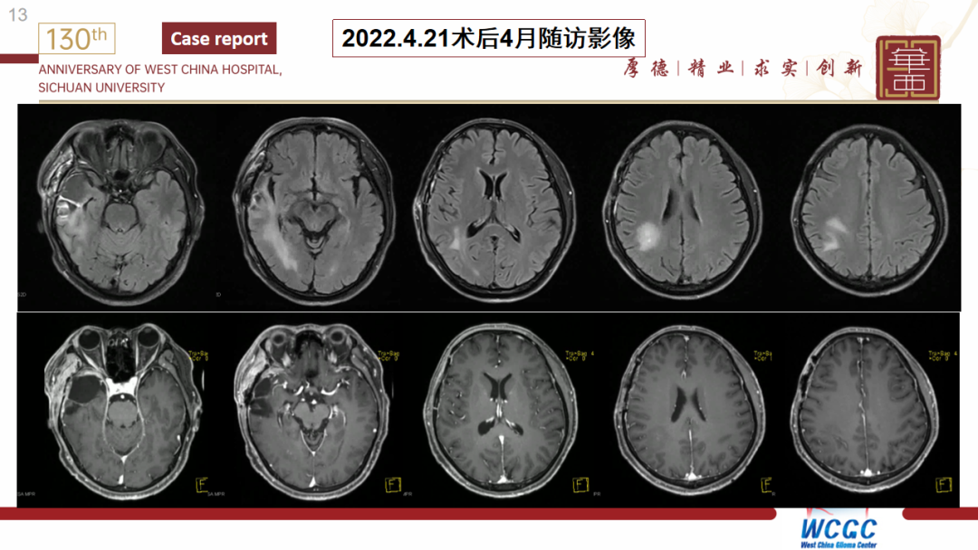 基因检测全是野生型好是不好_基因检测什么叫野生型_基因检测野生型什么意思