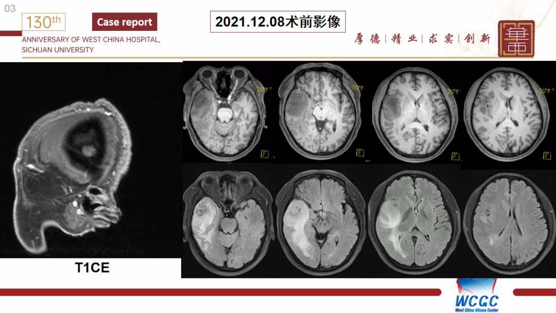 基因检测什么叫野生型_基因检测野生型什么意思_基因检测全是野生型好是不好