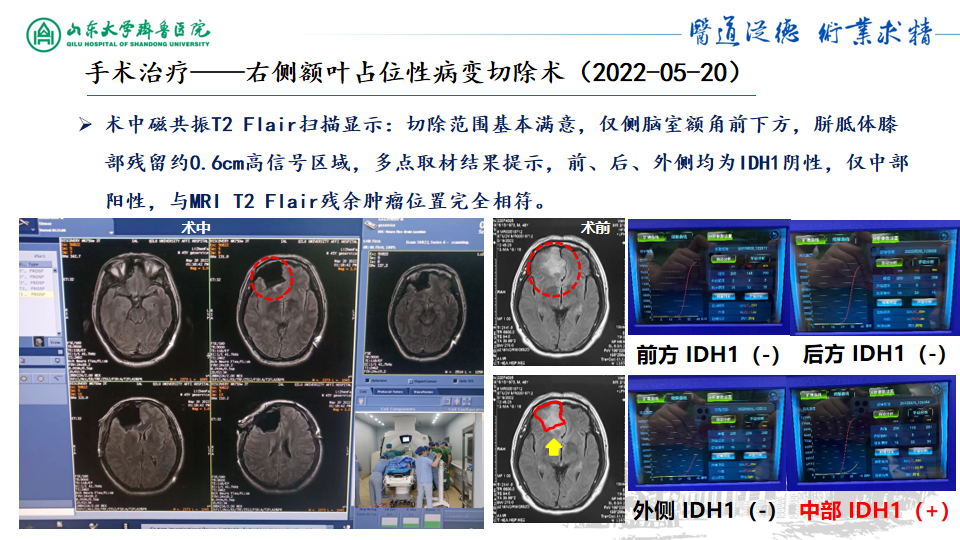 基因检测什么叫野生型_基因检测野生型什么意思_基因检测全是野生型好是不好