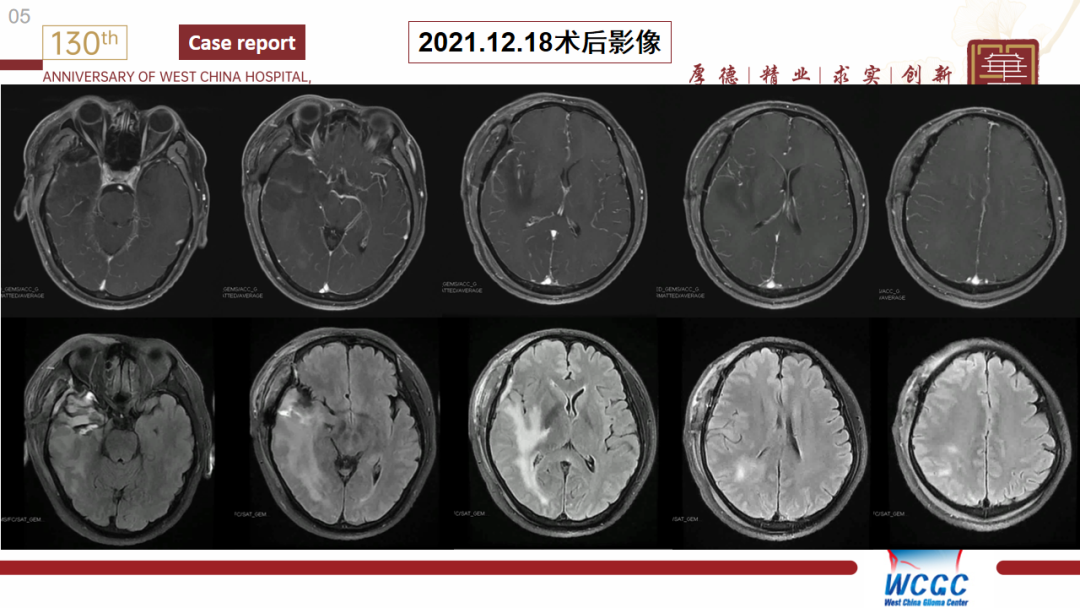 基因检测野生型什么意思_基因检测什么叫野生型_基因检测全是野生型好是不好