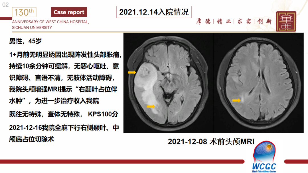 基因检测野生型什么意思_基因检测全是野生型好是不好_基因检测什么叫野生型