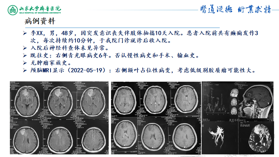基因检测野生型什么意思_基因检测全是野生型好是不好_基因检测什么叫野生型