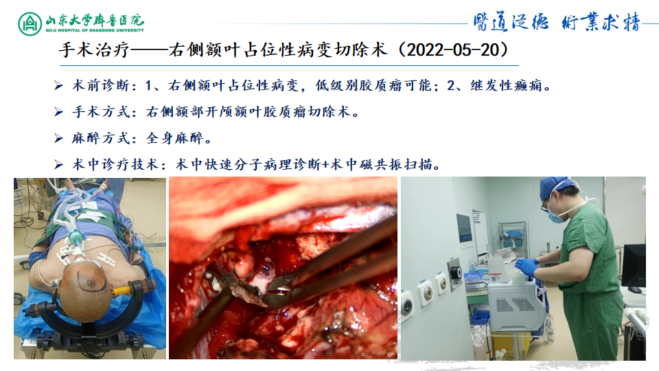 基因检测什么叫野生型_基因检测野生型什么意思_基因检测全是野生型好是不好