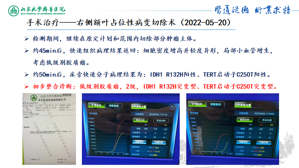 基因检测野生型什么意思_基因检测什么叫野生型_基因检测全是野生型好是不好
