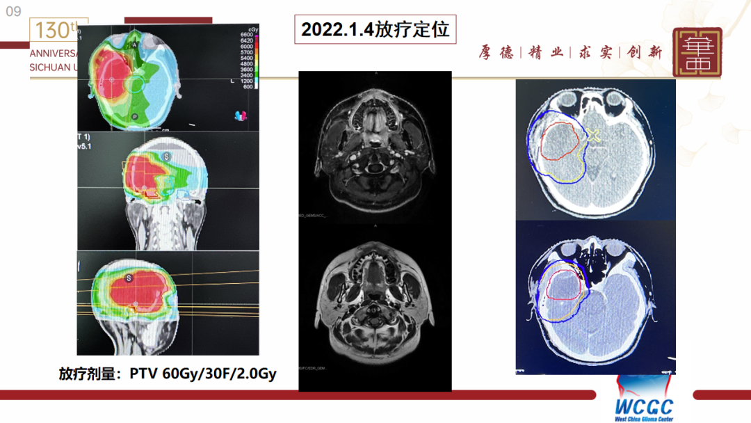基因检测全是野生型好是不好_基因检测野生型什么意思_基因检测什么叫野生型