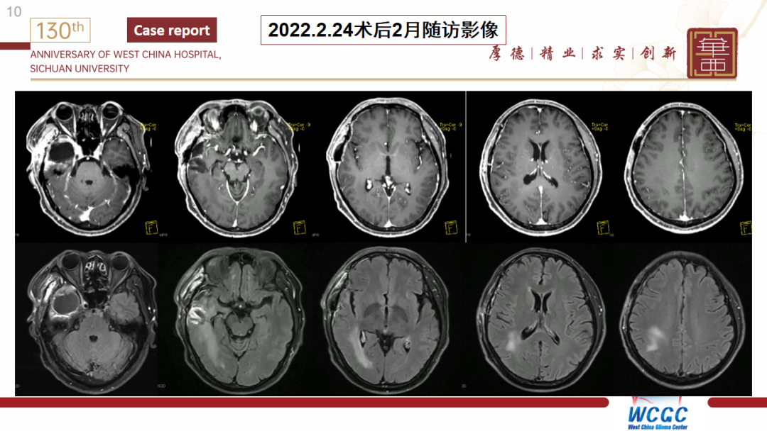 基因检测全是野生型好是不好_基因检测什么叫野生型_基因检测野生型什么意思