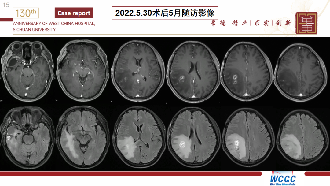 基因检测什么叫野生型_基因检测野生型什么意思_基因检测全是野生型好是不好