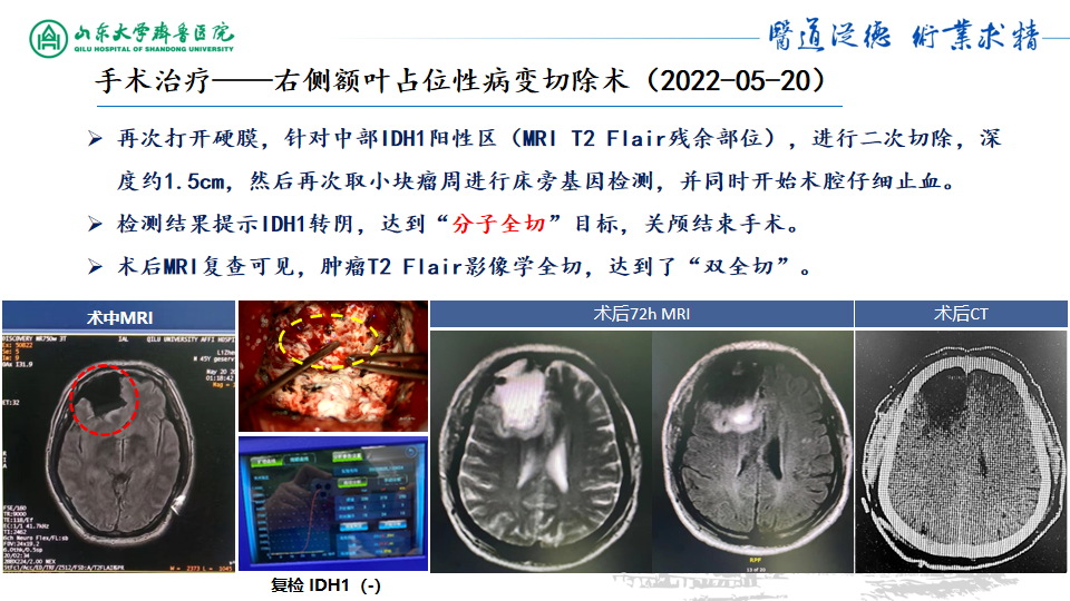 基因检测什么叫野生型_基因检测野生型什么意思_基因检测全是野生型好是不好