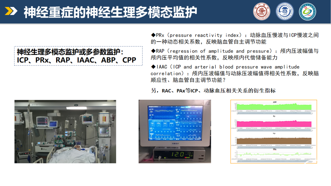 【监测有道】神经重症： 以prx为导向的最适脑灌注压和最适平均abp治疗——颅脑创伤-神经重症周刊（