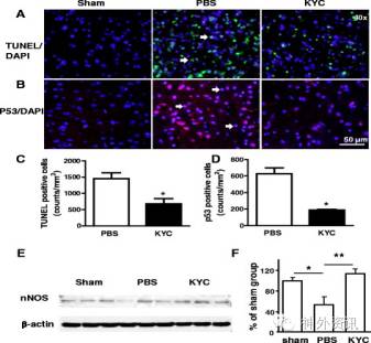 kyc對腦缺血後3天細胞凋亡(a和c),p53陽性細胞(b和d)和nnos表達(e的 