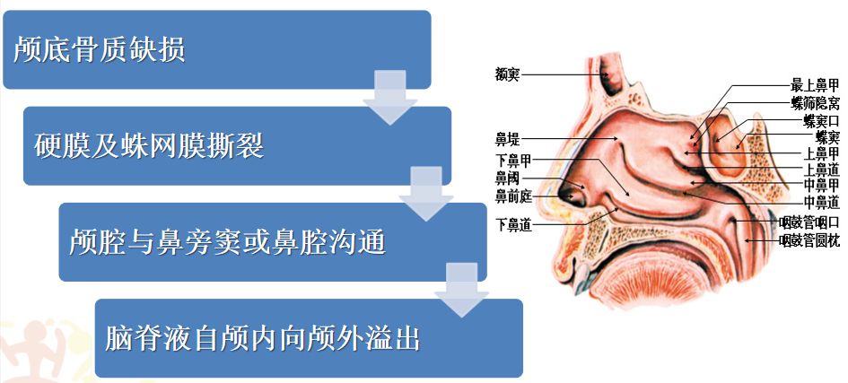 鼻漏的形成概 述神经内镜在颅底外科的应用-内镜解剖培训班风采内镜和