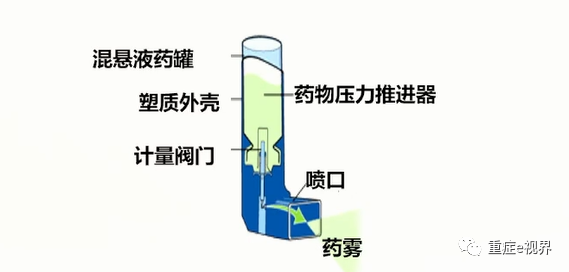 有创呼吸机怎么做雾化气道雾化吸入疗法需要关注的问题_https://www.jmylbn.com_新闻资讯_第15张