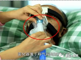 有创呼吸机怎么做雾化气道雾化吸入疗法需要关注的问题_https://www.jmylbn.com_新闻资讯_第27张