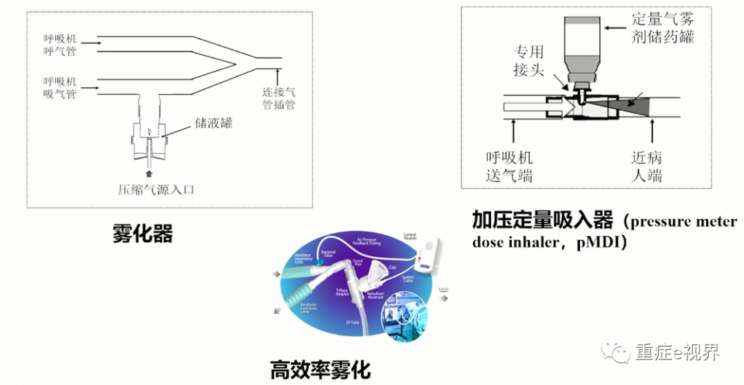 有创呼吸机怎么做雾化气道雾化吸入疗法需要关注的问题_https://www.jmylbn.com_新闻资讯_第18张