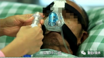 有创呼吸机怎么做雾化气道雾化吸入疗法需要关注的问题_https://www.jmylbn.com_新闻资讯_第26张