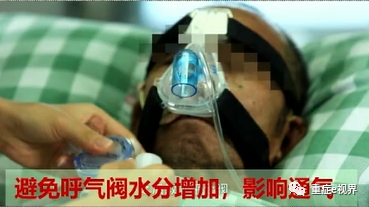 有创呼吸机怎么做雾化气道雾化吸入疗法需要关注的问题_https://www.jmylbn.com_新闻资讯_第25张