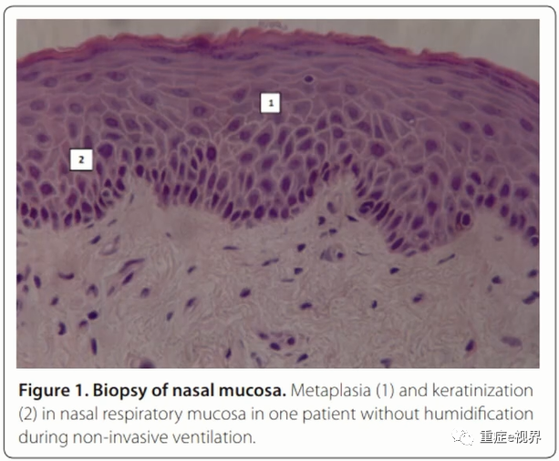 为什么要用湿化器无创辅助通气：湿化效果如何保证_https://www.jmylbn.com_新闻资讯_第12张