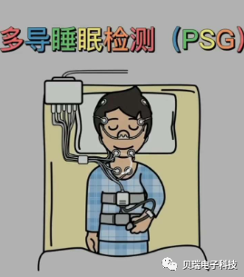 呼吸睡眠监测仪怎么用睡眠初筛监测（PM）与多导睡眠监测( PSG)的差别_https://www.jmylbn.com_新闻资讯_第3张