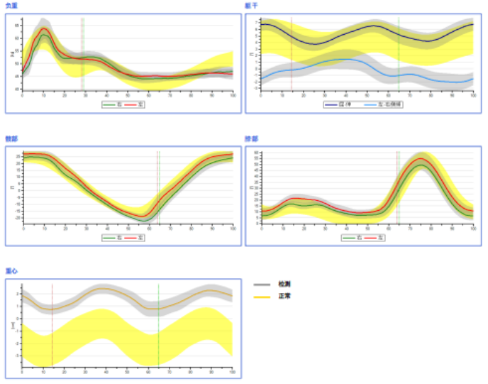 步态分析上曲线怎么解读青少年脊柱侧凸保守矫形康复评估体系—步态分析_https://www.jmylbn.com_新闻资讯_第15张