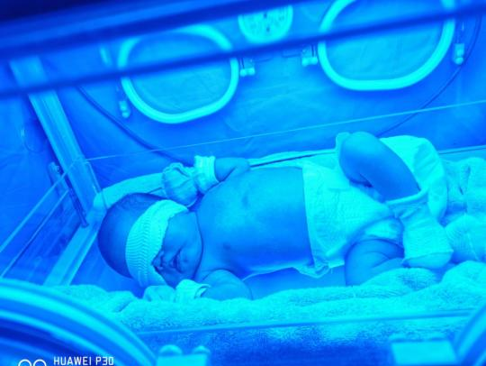 为什么要用光疗纸尿裤大朗医院重启日间光疗，“小黄人”们可以追光了！_https://www.jmylbn.com_新闻资讯_第5张