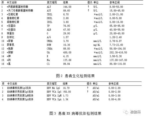 异型淋巴细胞高达14%,诊断却并非传染性单核细胞增多症