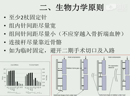 什么是外固定架深入讲解外固定支架_https://www.jmylbn.com_新闻资讯_第4张