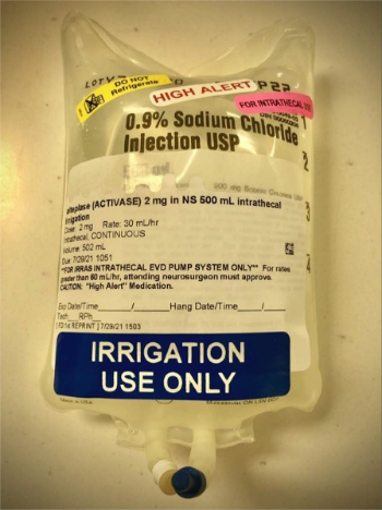 导管引流贴怎么贴IRRAflow导管（持续鞘注射药物引流装置）：优势和早期经验_https://www.jmylbn.com_新闻资讯_第6张