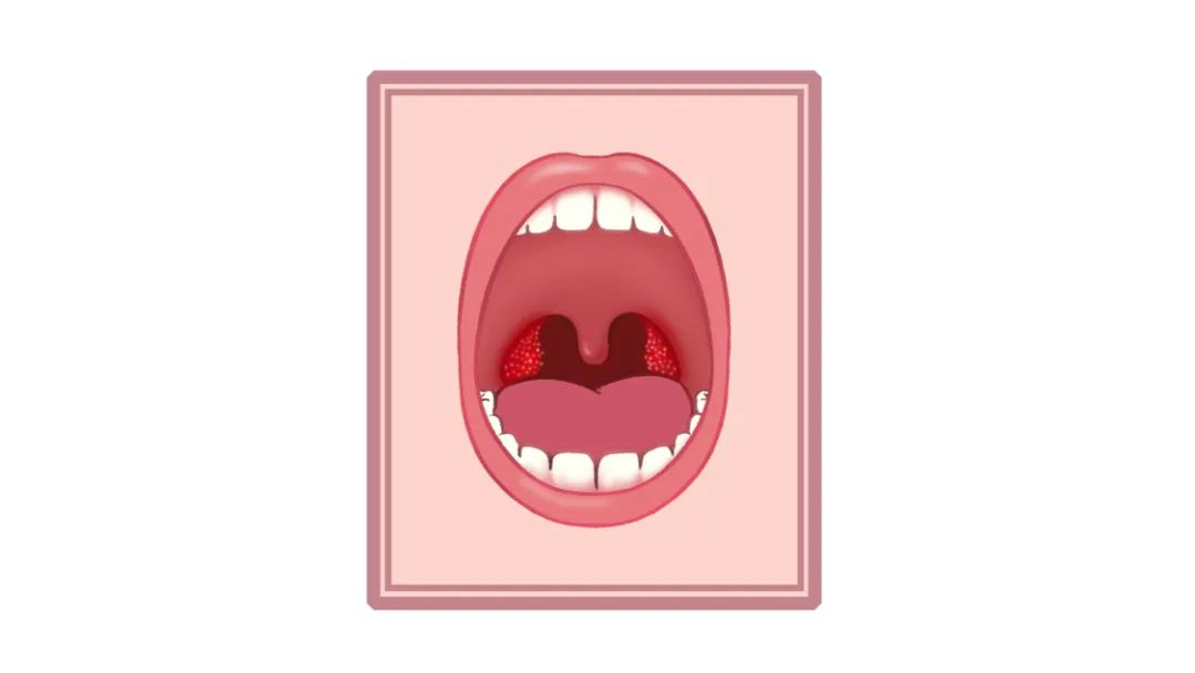 扁桃体一年发炎8次，还好我做对了这件事扁桃体3级肿大调理日记