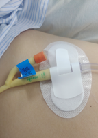 引流管怎么标识常见各类管道护理规范（评估、标识及固定）_https://www.jmylbn.com_新闻资讯_第3张