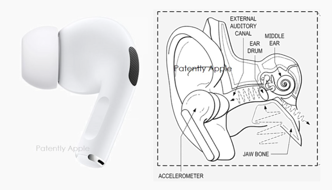 苹果新专利 | AirPods或将提供磨牙症的诊断和监测的图1