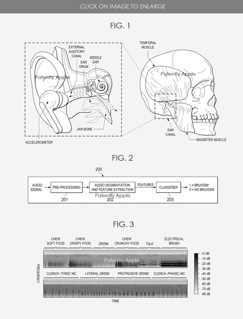 苹果新专利 | AirPods或将提供磨牙症的诊断和监测的图2