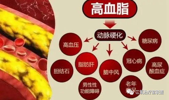 什么是臭氧大自血疗法【专家共识】三氧大自血疗法--血液好身体就好！_https://www.jmylbn.com_新闻资讯_第7张
