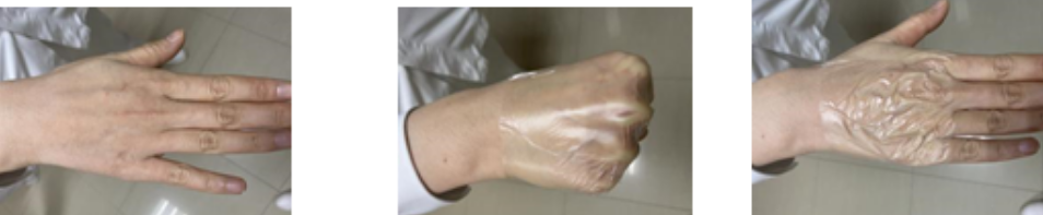 为什么输血不能用小针护士，留置针又不滴了！其实只需做一个小改变...._https://www.jmylbn.com_新闻资讯_第8张