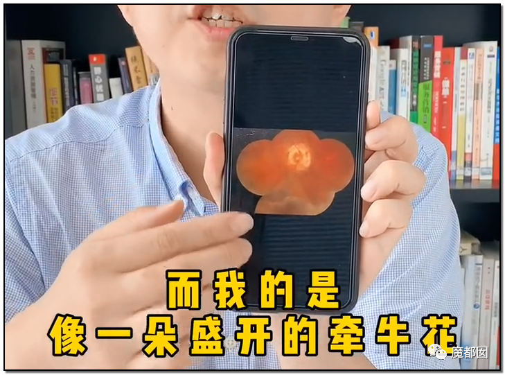 谩骂唾弃攻击！抖音盲人网红的遭遇让我们看清中国盲人现状（组图） - 10