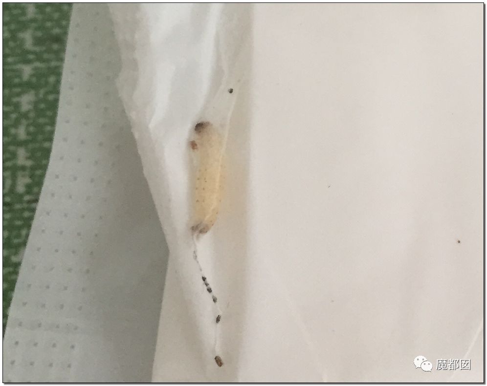慎点！大牌卫生巾竟都是虫卵！孵化了在体内长蛆...（组图） - 40