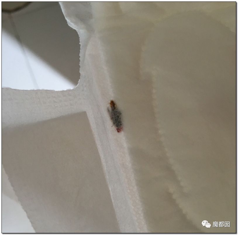 慎点！大牌卫生巾竟都是虫卵！孵化了在体内长蛆...（组图） - 37