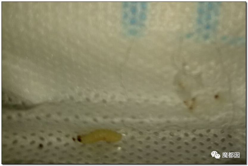 慎点！大牌卫生巾竟都是虫卵！孵化了在体内长蛆...（组图） - 53