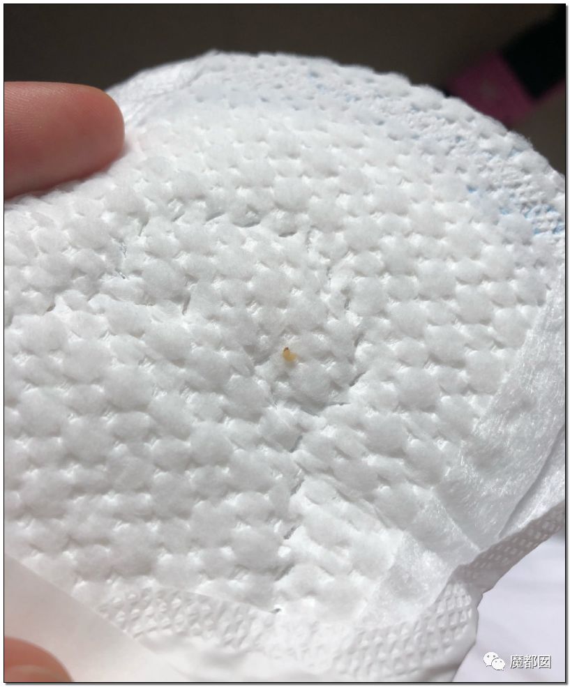 慎点！大牌卫生巾竟都是虫卵！孵化了在体内长蛆...（组图） - 62