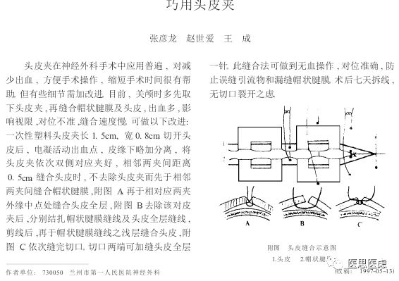 手术头皮夹怎么放神外有趣的小物件---头皮夹_https://www.jmylbn.com_新闻资讯_第8张