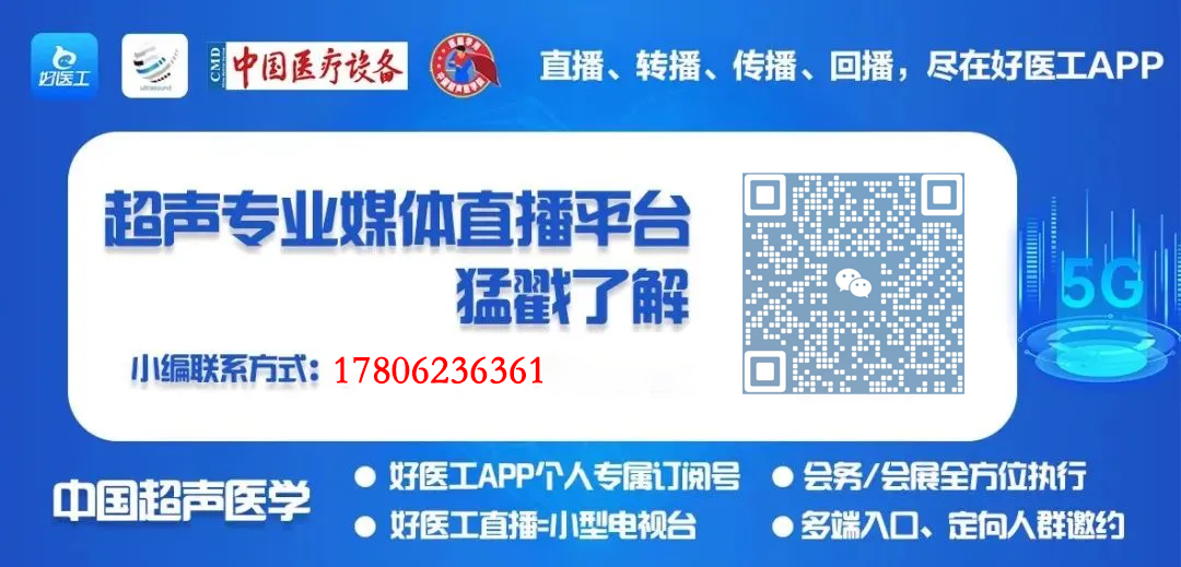 什么是超声容积探头超声探头分类及工作原理_https://www.jmylbn.com_新闻资讯_第14张